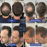 NorthHair Hårfylder™